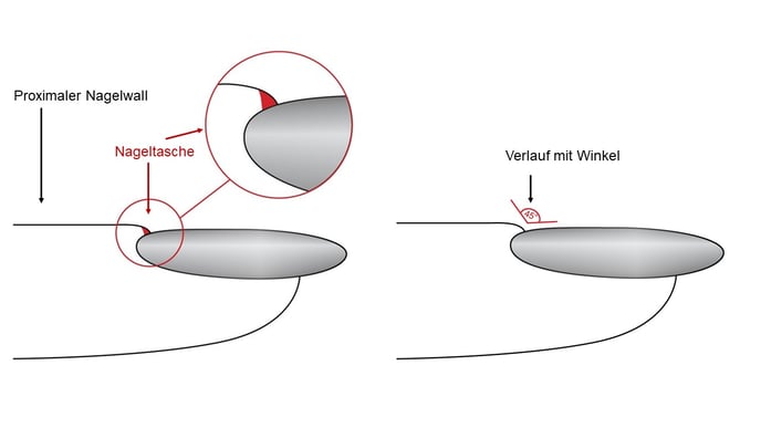 ICG Artikel TSC _DE