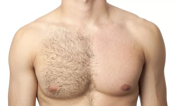 Is waxing/sugaring suitable for men?