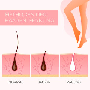 Translated_Square_Types-of-hair-removal-normal-shaving-waxing_DACH