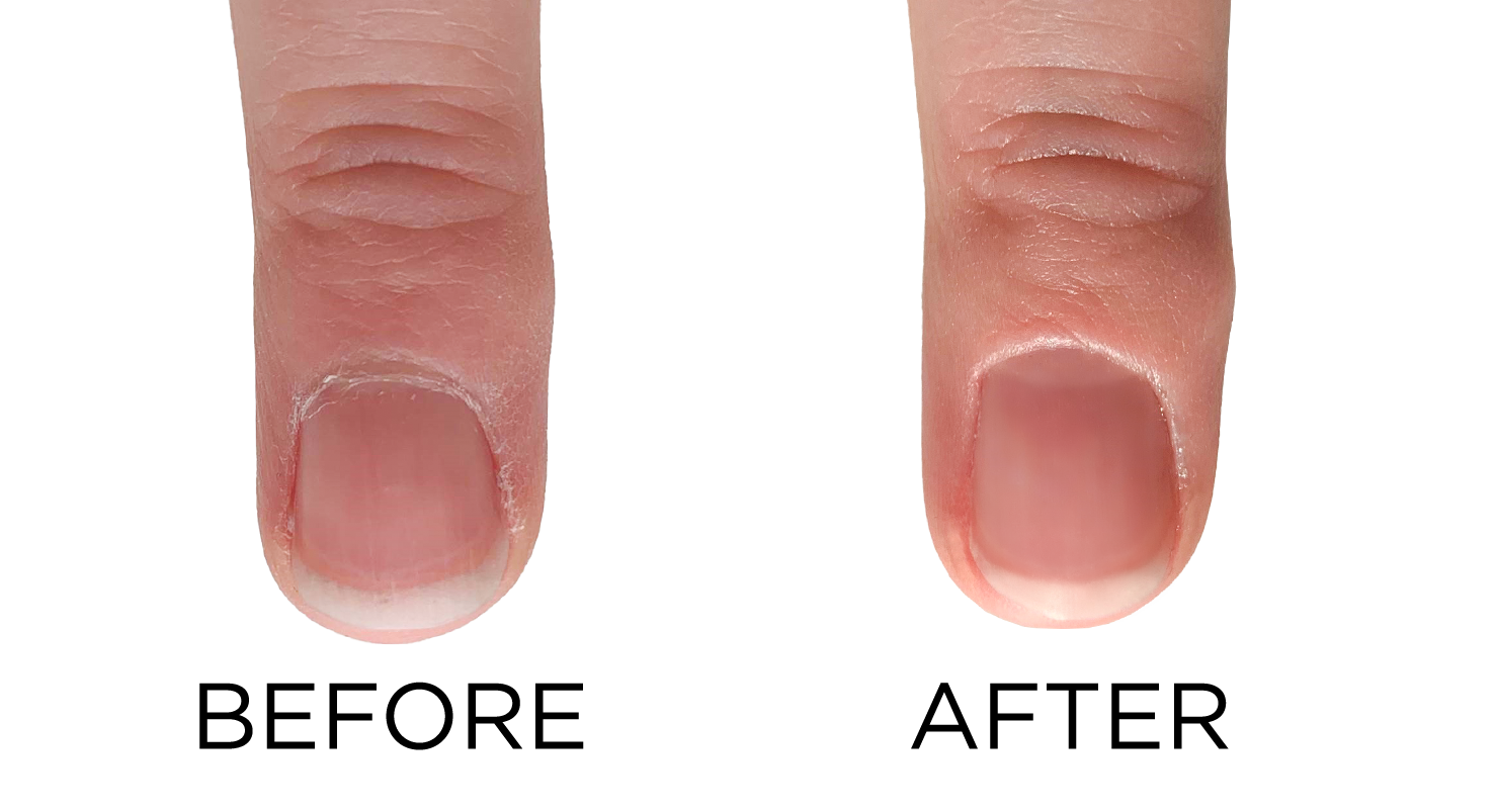 middle-finger-Before-AFTER-dadi-oil_transparent_4